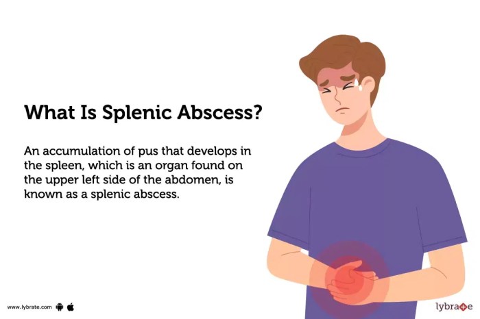 Abscess causes and treatment