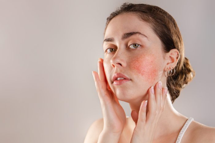 Understanding What is Sensitive Skin