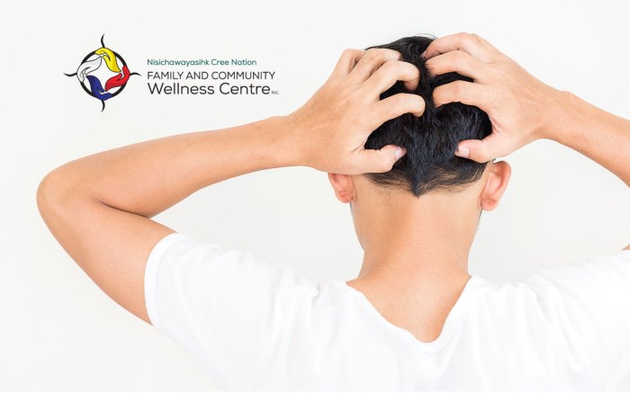 How to prevent and avoid head lice