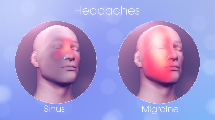 Your Sinus Headache Could Be Migraine - Scientific Animations Sinus infection or migraine