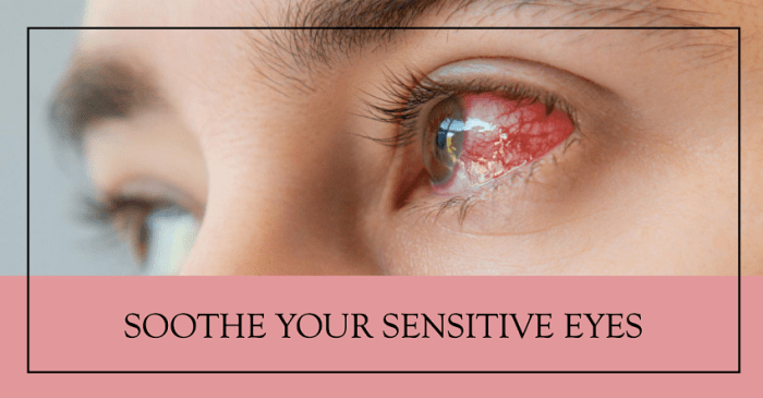 Dealing with flaky eyelids
