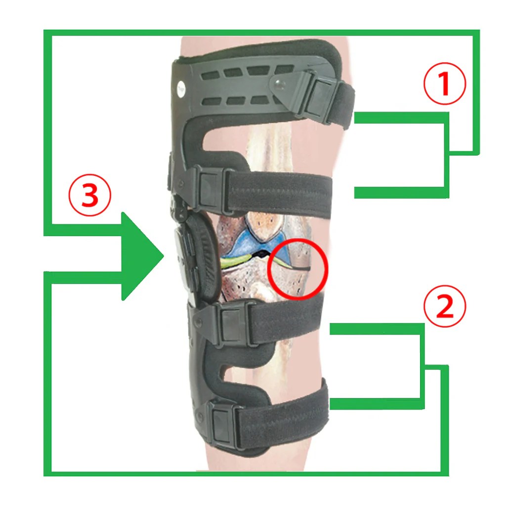 What is an unloader knee brace
