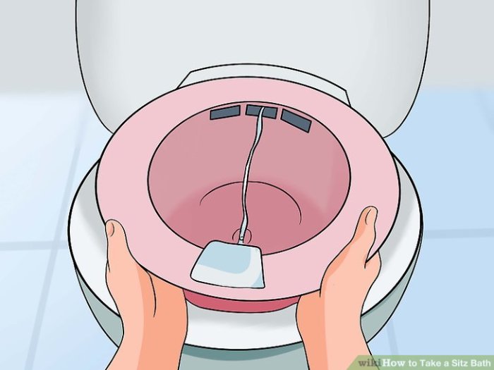 How to Take a Sitz Bath: 14 Steps (with Pictures) - wikiHow How to take a sitz bath