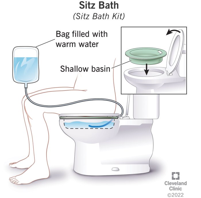 5 Powerful Benefits of Taking a Sitz Bath for Postpartum Recovery and ... How to take a sitz bath