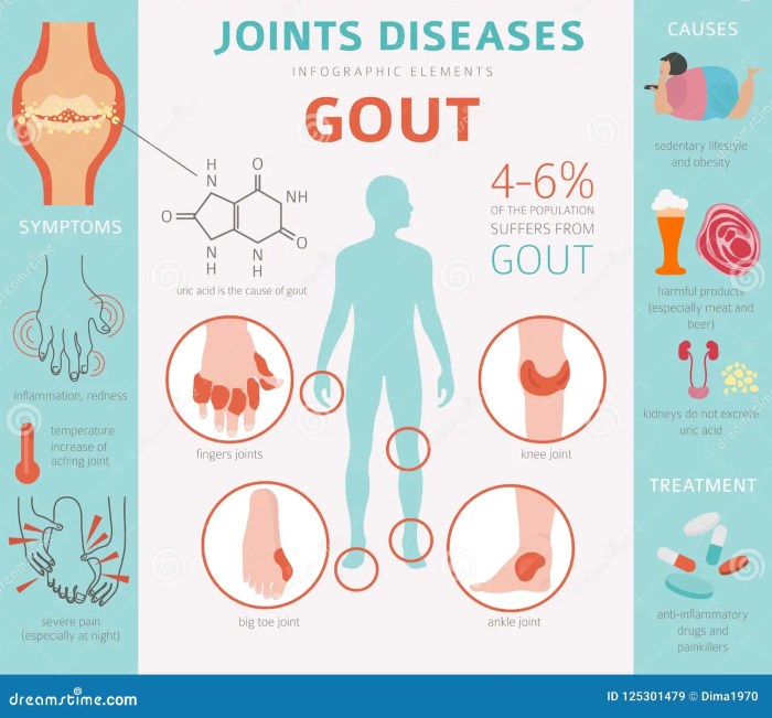 Is gout an autoimmune disease