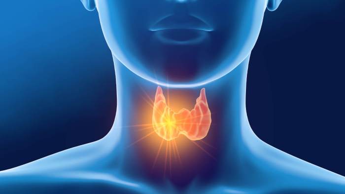 Thyroid Thyroid cancer signs symptoms complications