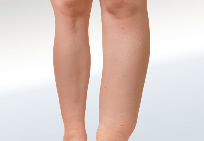 Understanding and Managing Leg Swelling: Causes, Symptoms, and ... Lower back pain and swelling in legs and feet