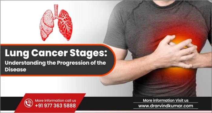 Types of lung cancer