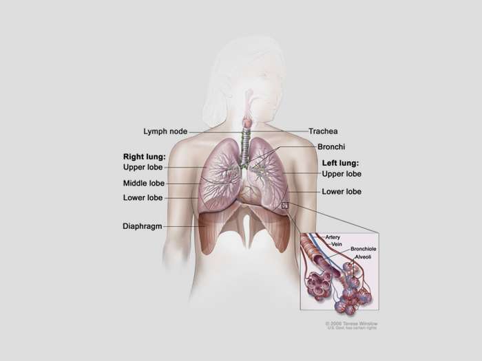 What is primary lung cancer