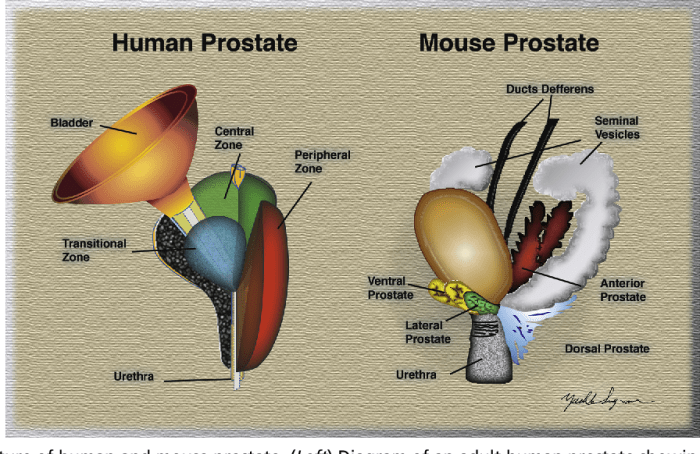 What happens when hormone treatment for prostate cancer stops working