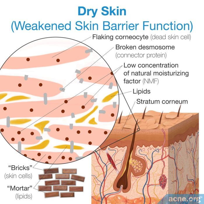 How to Treat Dry Skin On Your Face - Forefront Dermatology