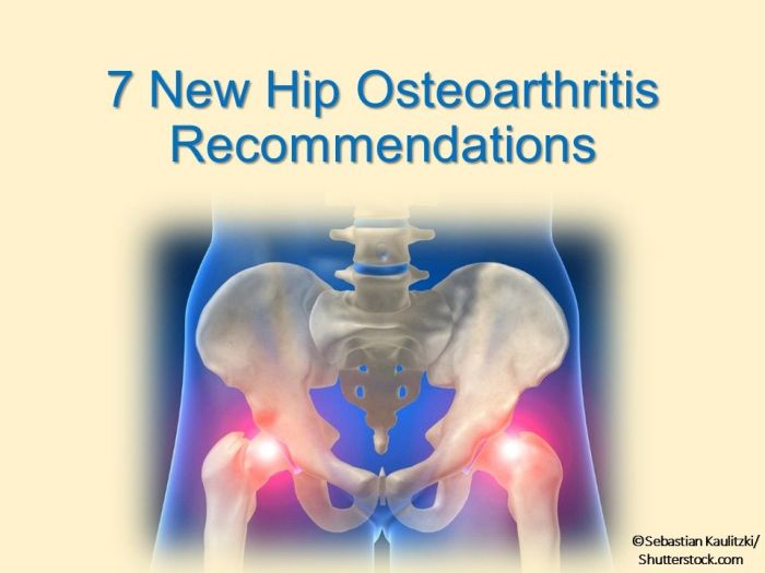 Stages of Osteoarthritis of the Hip A Comprehensive Guide