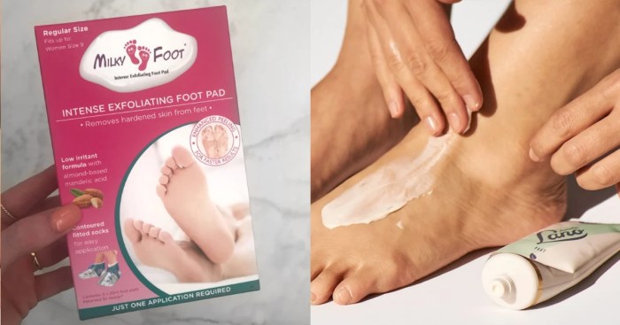 Coping with dry cracked feet