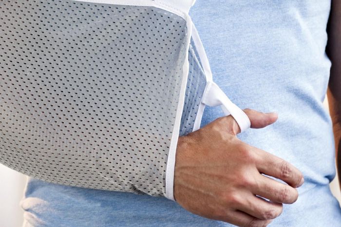 How to properly wear a sling on your arm