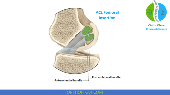 Acl tear surgery rehab how long does does it take