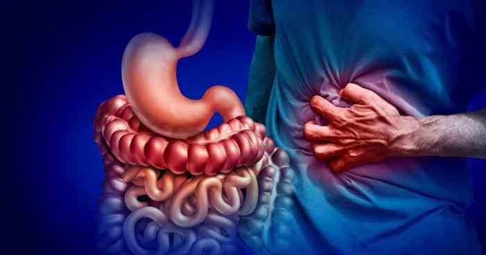 What Causes Ulcerative Colitis | Pompa Program Masterclass Ulcerative colitis causes and risk factors