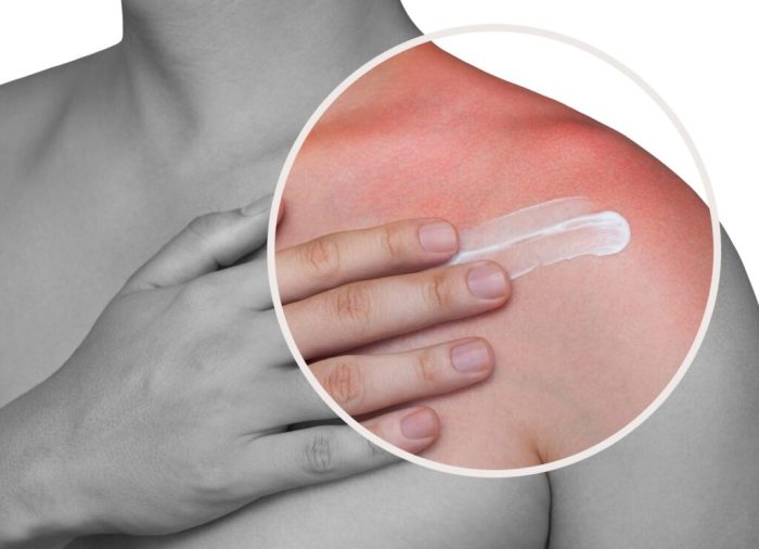 Allergic to skin care products