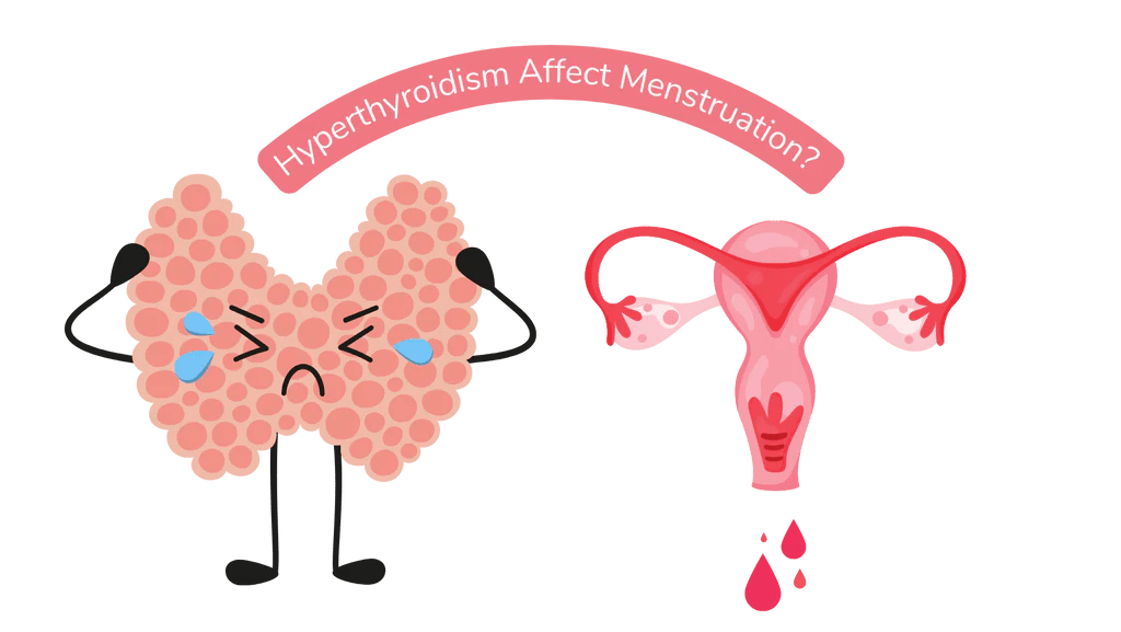 Menstrual problems and thyroid disease