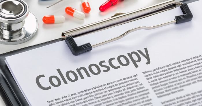 Do You Know How Often You Should Get a Colonoscopy? - Birmingham ... How often should you get a colonoscopy