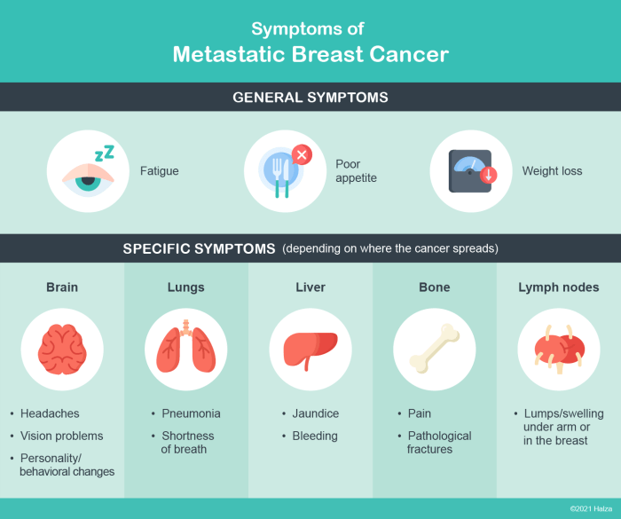 Stage 4 (Advanced or Metastatic) Breast Cancer | NBCF Complications of advanced metastatic breast cancer