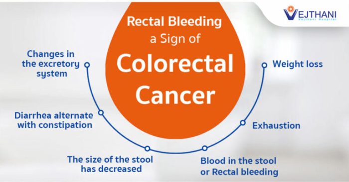 Diagnosing colorectal cancer early matters