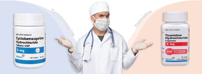 Tizanidine vs cyclobenzaprine what s the difference