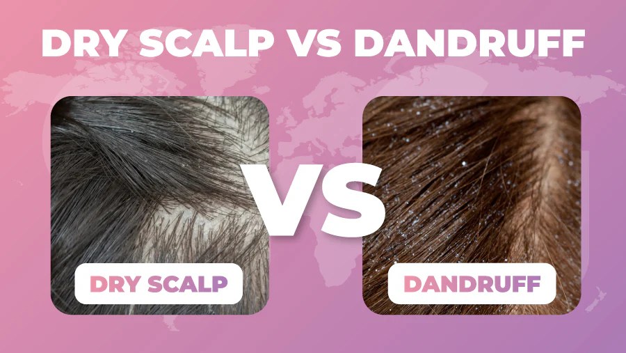 Dandruff vs Dry Scalp A Deep Dive
