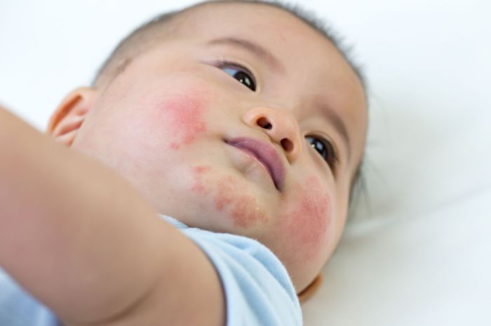 Allergic Reactions on Face: Symptoms, Causes, Treatment Allergic asthma medication side effects