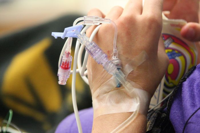 Common Skin Problems During Chemotherapy Chemotherapy for lung cancer