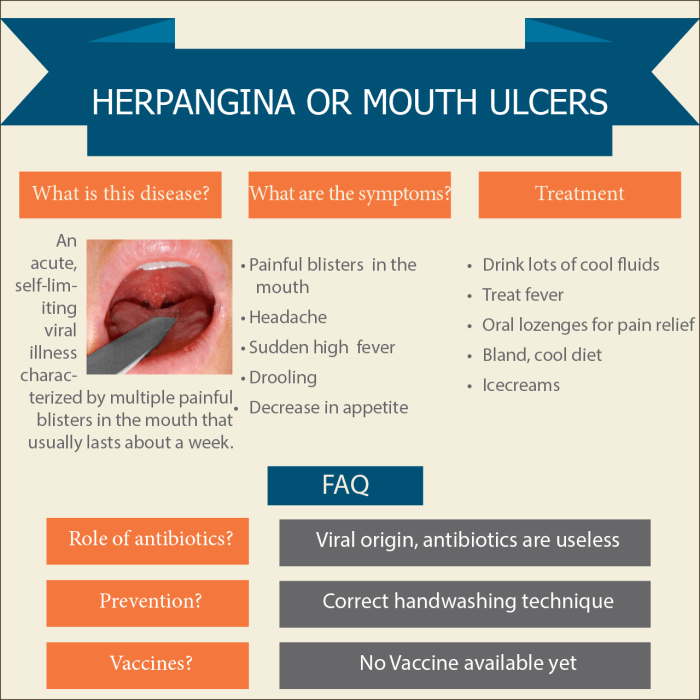 Herpangina viral infection of the mouth and throat