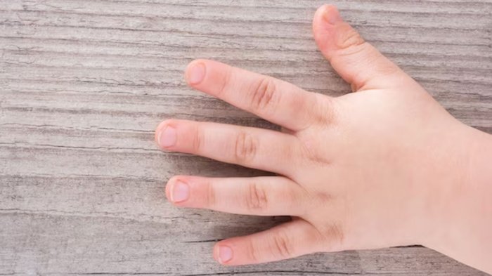 Fingers locking up straight no pain