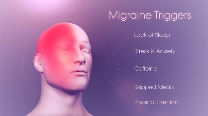 What is a migraine without aura