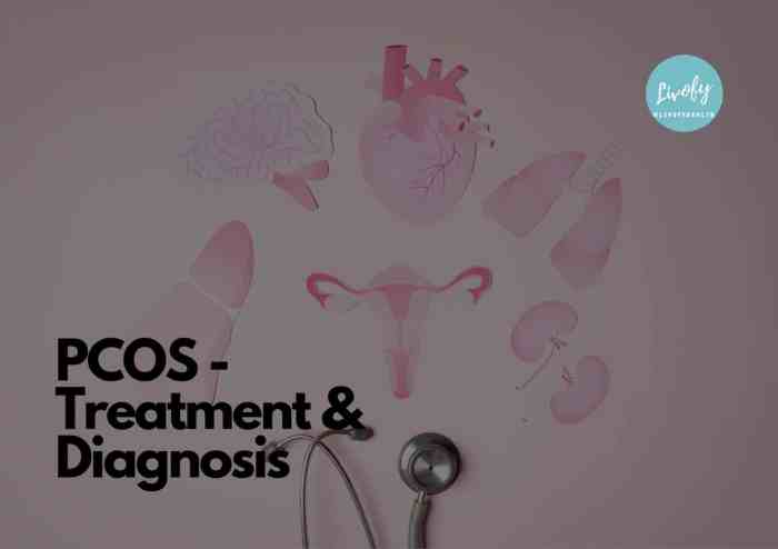 Androgens and pcos excess levels what it means