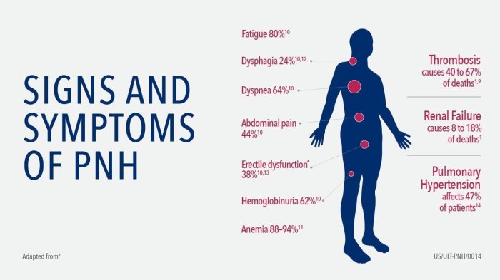 Paroxysmal nocturnal hemoglobinuria Paroxysmal nocturnal hemoglobinuria symptoms