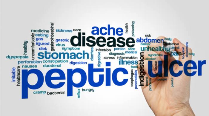 Diet Chart For peptic ulcer Patient, Peptic Ulcer Diet chart | Lybrate. What can i eat if i have a peptic ulcer