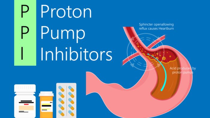 Side Effects of Proton Pump Inhibitors A Deep Dive