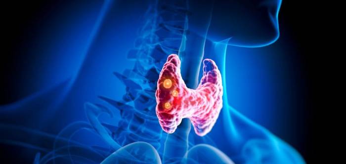 Thyroid Gland Anatomy Thyroid disease and diabetes