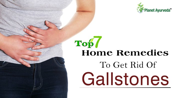 How to get rid of gallstones