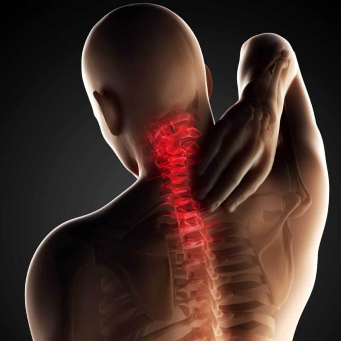 Causes of Back Spasms Unveiling the Reasons