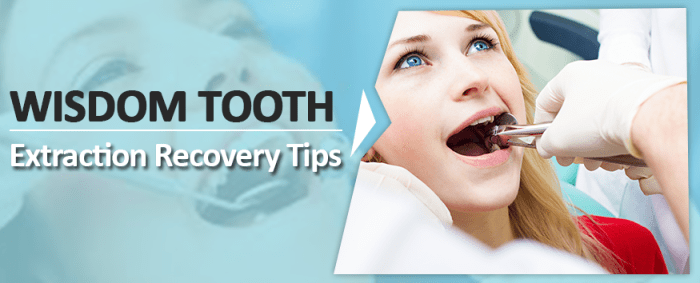 9 Home Remedies For Wisdom Tooth Pain | Search Home Remedy 9 Home Remedies For Wisdom Tooth Pain | Search Home Remedy