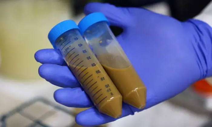 Fecal microbiota transplants improve metabolic syndrome in obese patients Why you shouldnt try a fecal transplant at home