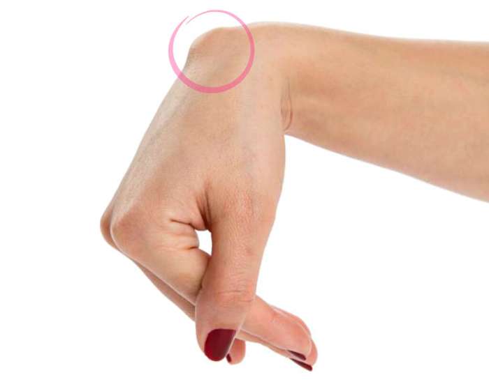 Normal Wrist #2 Photograph by Science Photo Library - Pixels Normal Wrist #2 Photograph by Science Photo Library - Pixels