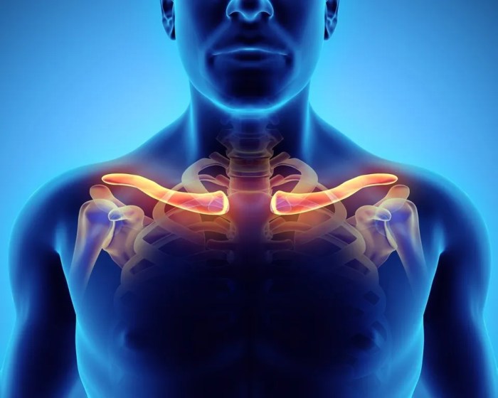 Surgery for clavicle fractures