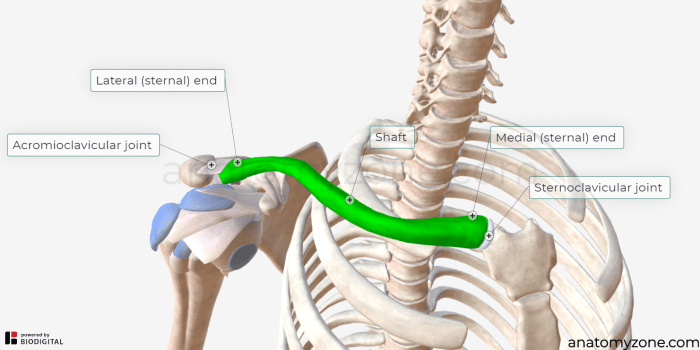 Surgery for Clavicle Fractures A Comprehensive Guide