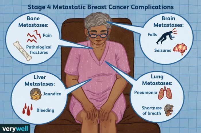 Complications of advanced metastatic breast cancer