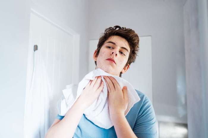 Episode 49: Preventing And Treating Acne In Teen Treating teen acne in boys