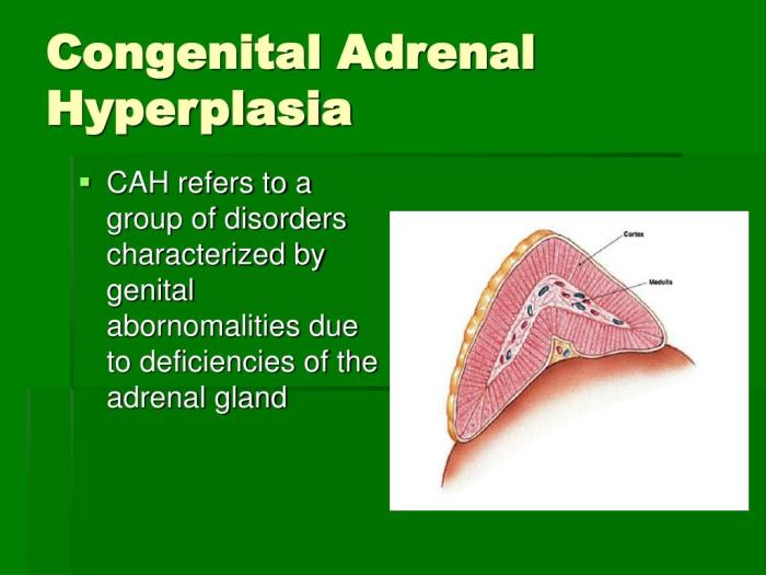 Congenital Adrenal Hyperplasia Congenital adrenal hyperplasia overview
