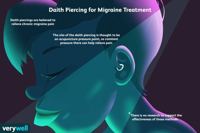 Daith Piercing for Migraine Daith Piercing for Migraine