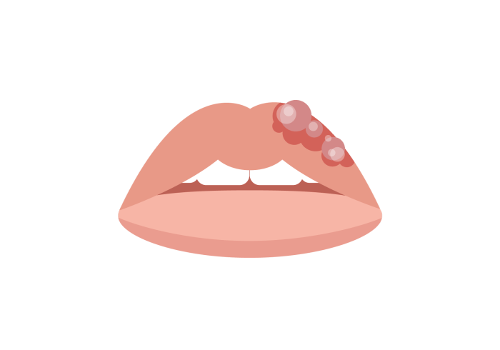 What Causes Swollen Lips? A Deep Dive