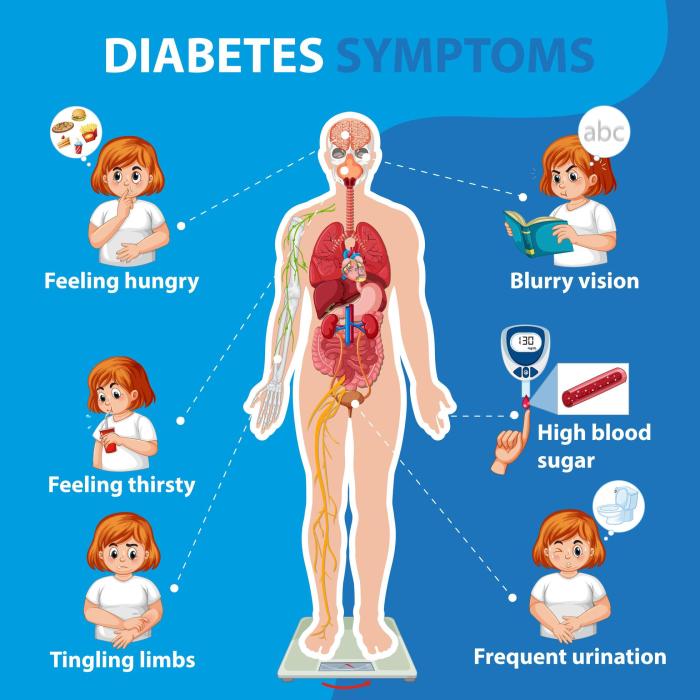 Diabetes Symptoms information infographic 1436750 Vector Art at Vecteezy Diabetes and yeast infections